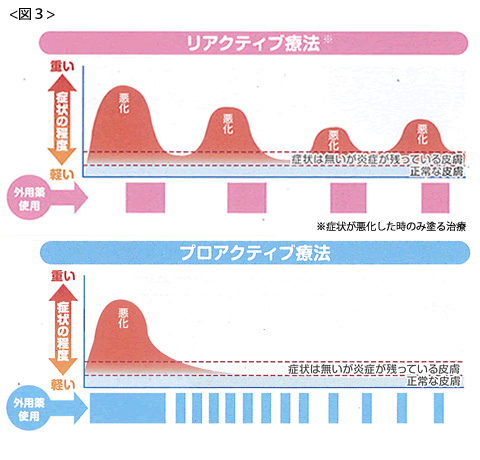 アトピー性皮膚炎 | 豊中市の小児科・アレルギー科かめさきこども・アレルギークリニック