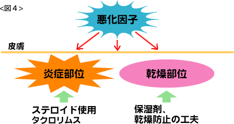 [図4]炎症部位にはステロイドを使用し、感想部位には保湿剤、感想防止の工夫をするなどして悪化因子を防いていきます。