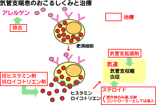 気管支喘息のおこるしくみと治療の説明図です。